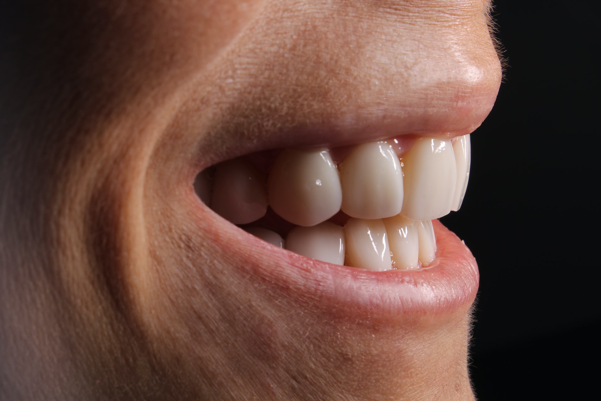 ¿Cuanto cuesta una prótesis dental de un solo diente?