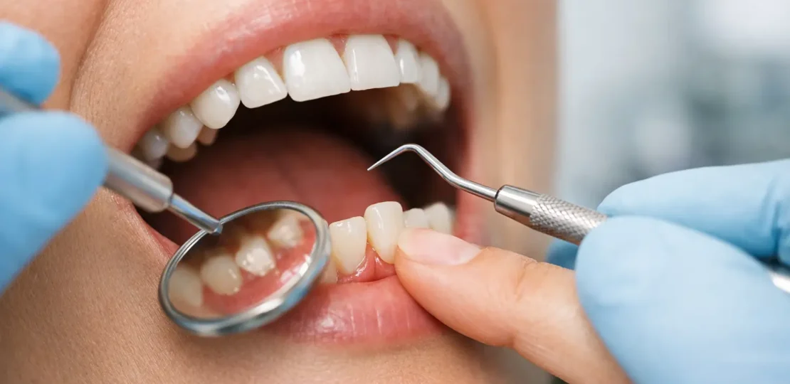 ¿Por qué se aflojan los dientes?