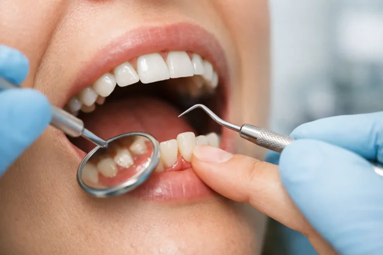 ¿Por qué se aflojan los dientes?