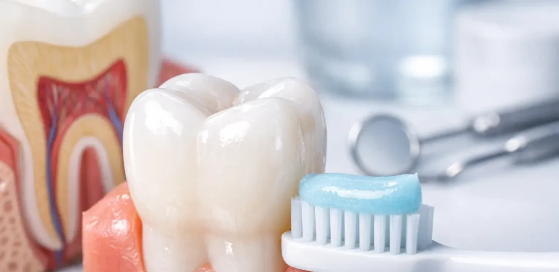 ¿Qué es el esmalte dental y cómo cuidarlo?
