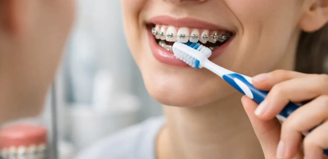 ¿Cómo cepillarse con brackets correctamente?