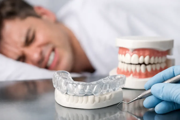 ¿Cómo proteger dientes con bruxismo?