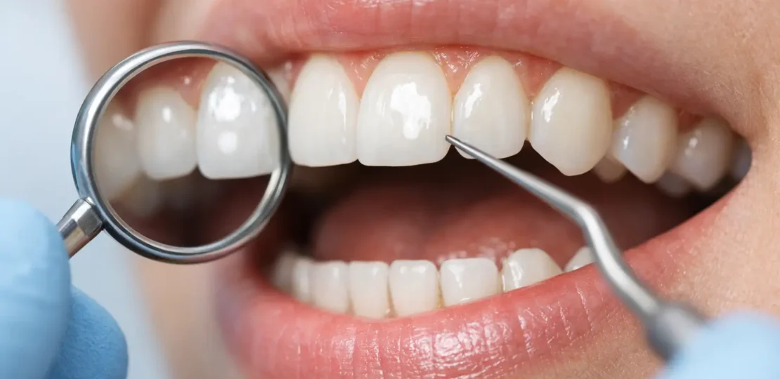 ¿Por qué salen manchas blancas en los dientes?
