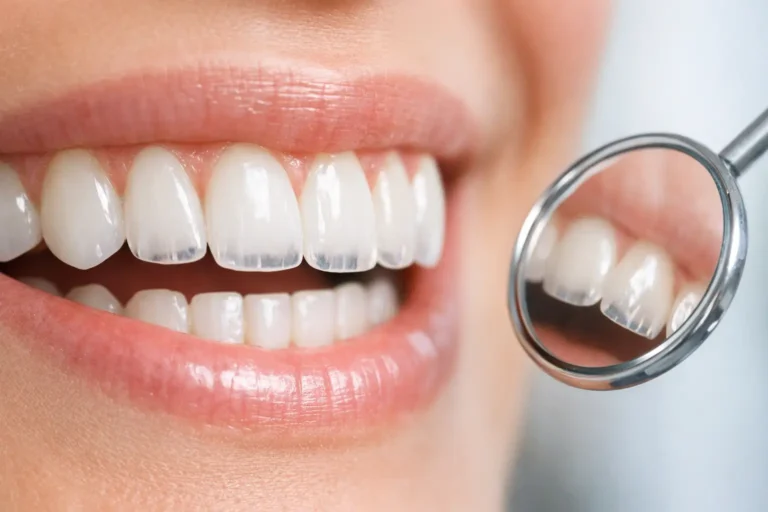 ¿Dientes transparentes en las puntas?
