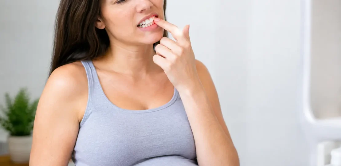 Ejemplo de gingivitis por embarazo y qué hacer