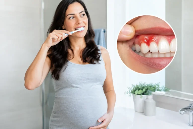¿Puede el embarazo causar gingivitis y sangrado?