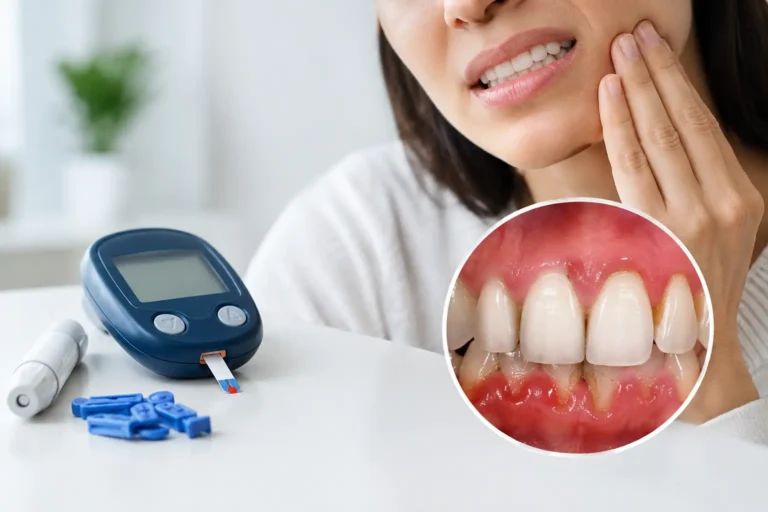 ¿Puede la diabetes causar periodontitis dental?